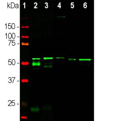Western Blot: Peripherin Antibody (8G2) [NB300-138]