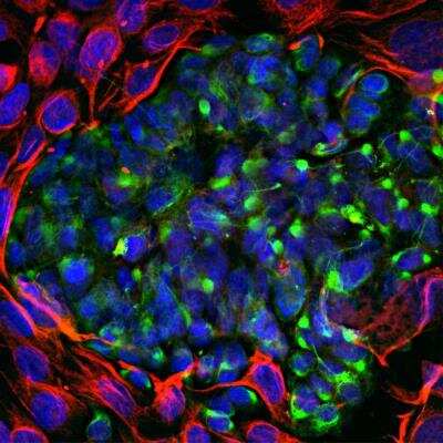 Immunocytochemistry/ Immunofluorescence: Peripherin Antibody [NBP1-05423]