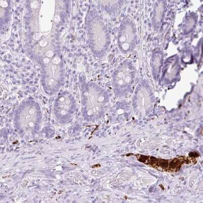 Immunohistochemistry-Paraffin: Peripherin Antibody [NBP2-38444]