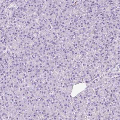 Immunohistochemistry-Paraffin: Peripherin Antibody [NBP2-38444]