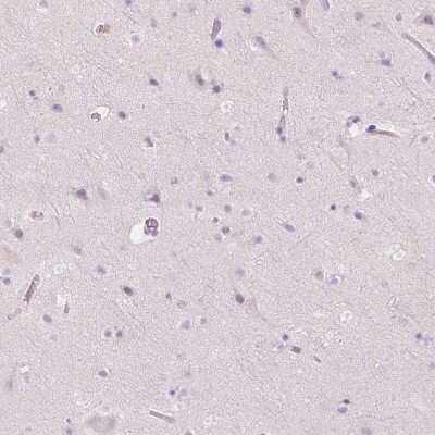 Immunohistochemistry-Paraffin: Peripherin Antibody [NBP2-39008]