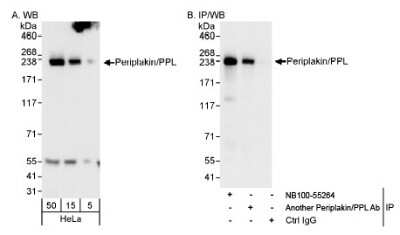 Western Blot: Periplakin Antibody [NB100-55264]