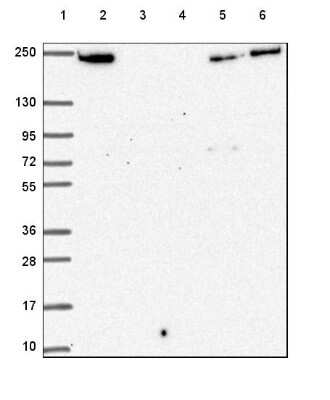 Western Blot: Periplakin Antibody [NBP2-49306]