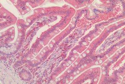 Immunohistochemistry-Paraffin: Peroxiredoxin 1 Antibody [NBP1-06064]