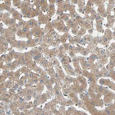 Immunohistochemistry-Paraffin: Peroxiredoxin 1 Antibody [NBP1-82558]