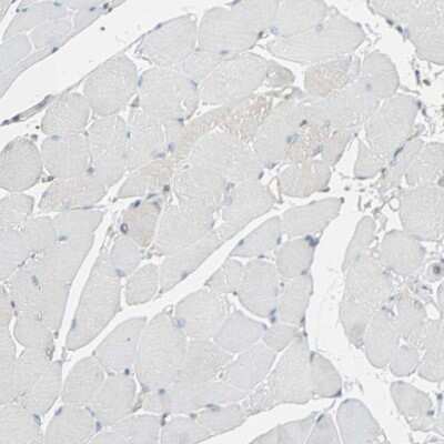 Immunohistochemistry-Paraffin: Peroxiredoxin 1 Antibody [NBP1-82558]