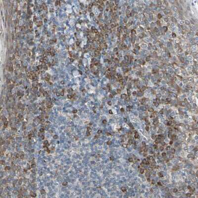 Immunohistochemistry-Paraffin: Peroxiredoxin 1 Antibody [NBP1-82558]