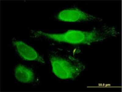 Immunocytochemistry/ Immunofluorescence: Peroxiredoxin 2 Antibody (4E10-2D2) [H00007001-M01]