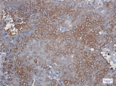 Immunohistochemistry-Paraffin: Peroxiredoxin 2 Antibody (S02-1G5) [NBP3-19735]