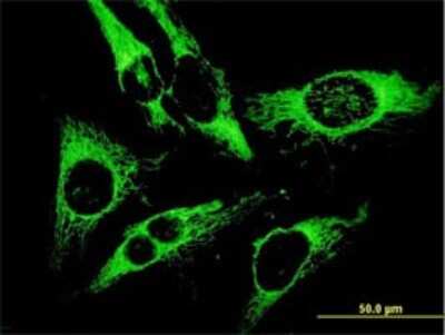 Immunocytochemistry/ Immunofluorescence: Peroxiredoxin 3 Antibody (1E3-B2) [H00010935-M01]