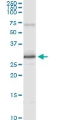 Immunoprecipitation: Peroxiredoxin 3 Antibody (1E3-B2) [H00010935-M01]