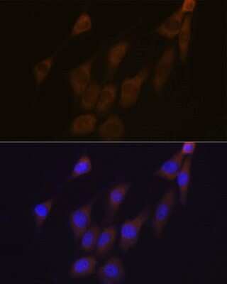 Immunocytochemistry/ Immunofluorescence: Peroxiredoxin 4 Antibody (9E7V0) [NBP3-16760]