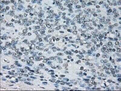 Immunohistochemistry: Peroxiredoxin 4 Antibody (OTI9A3) - Azide and BSA Free [NBP2-73338]