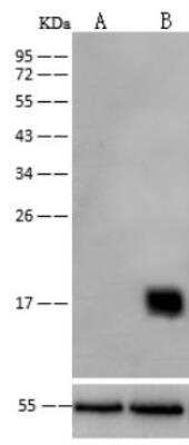 Knockout Validated: Peroxiredoxin 5 Antibody (002) [NBP2-89862]