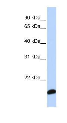 Western Blot: Peroxiredoxin 5 Antibody [NBP1-58348]