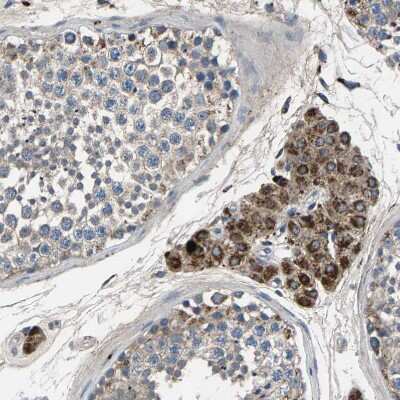 Immunohistochemistry: Peroxiredoxin Like 2C Antibody [NBP1-91073]