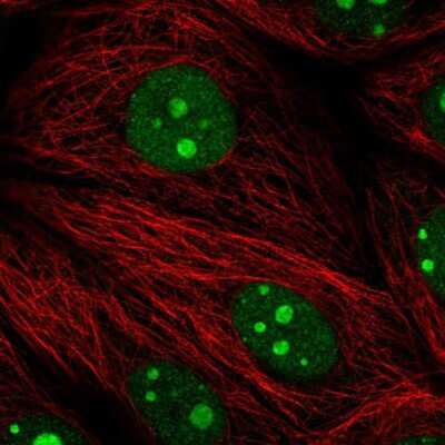 Immunocytochemistry/ Immunofluorescence: Pescadillo Antibody [NBP2-56329]