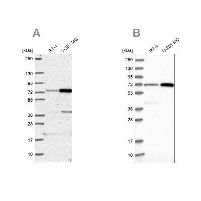 Western Blot: Pescadillo Antibody [NBP2-56329]