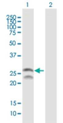 Western Blot: Pet1 Antibody [H00054738-B02P]