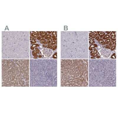 Immunohistochemistry-Paraffin: Phenylalanine Hydroxylase Antibody [NBP1-80917]