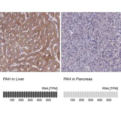 Immunohistochemistry-Paraffin: Phenylalanine Hydroxylase Antibody [NBP2-48615]