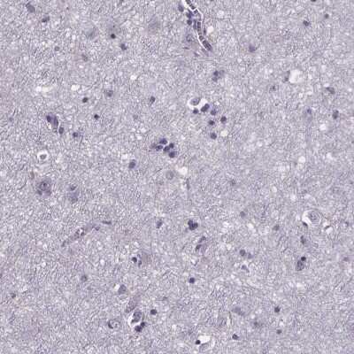 Immunohistochemistry-Paraffin: Phenylalanine Hydroxylase Antibody [NBP2-48615]