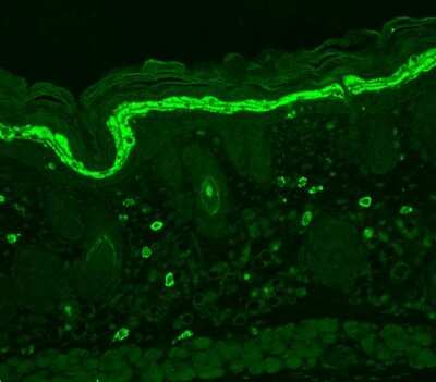 Immunohistochemistry: Phospho-Tyrosine Antibody (G104) [NBP1-47562]