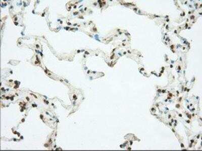 Immunohistochemistry-Paraffin: Phosphodiesterase 4A/PDE4A Antibody (OTI1C8) [NBP2-02559]
