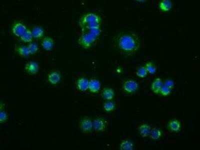 Immunocytochemistry/ Immunofluorescence: Phosphodiesterase 4A/PDE4A Antibody (OTI1C8) - Azide and BSA Free [NBP2-73376]