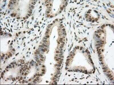 Immunohistochemistry: Phosphodiesterase 4A/PDE4A Antibody (OTI1C8) - Azide and BSA Free [NBP2-73376]