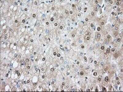 Immunohistochemistry: Phosphodiesterase 4A/PDE4A Antibody (OTI1C8) - Azide and BSA Free [NBP2-73376]