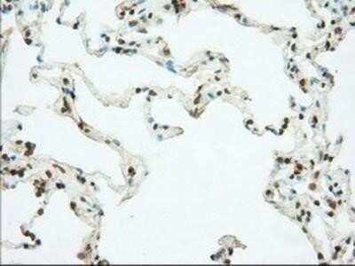 Immunohistochemistry: Phosphodiesterase 4A/PDE4A Antibody (OTI1C8) - Azide and BSA Free [NBP2-73376]