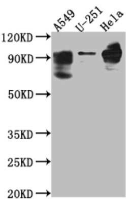 Western Blot: Phosphodiesterase 4D Antibody (4D4) [NBP3-15210]