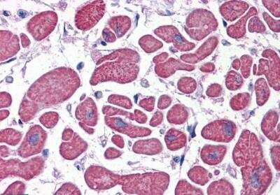 Immunohistochemistry-Paraffin: Phosphodiesterase 4D Antibody [NB100-2462]