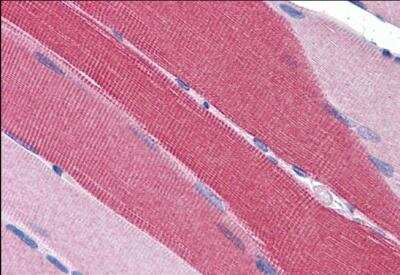 Immunohistochemistry-Paraffin: Phosphodiesterase 4D Antibody [NB100-2462]