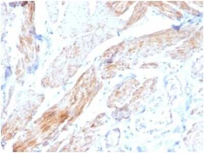 Immunohistochemistry-Paraffin: Phosphoglucomutase 5 Antibody (PGM5/3552) [NBP3-13996]