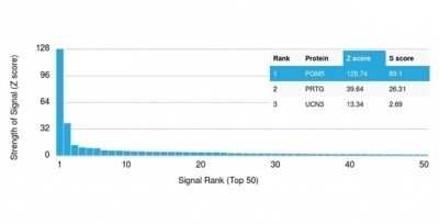 Protein Array: Phosphoglucomutase 5 Antibody (PGM5/3552) [NBP3-13996]