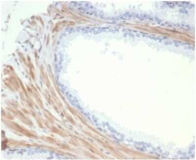 Immunohistochemistry-Paraffin: Phosphoglucomutase 5 Antibody (PGM5/7005R) [NBP3-13731]