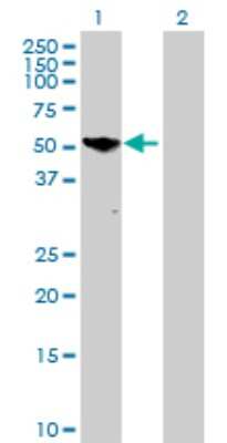 Western Blot: Phosphoglucomutase 5 Antibody [H00005239-B01P]