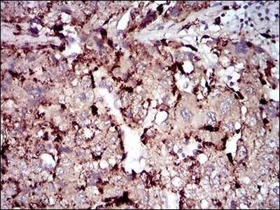 Immunohistochemistry: Phospholipase A2 XII Antibody (3H2C11) - BSA Free [NBP2-37255]