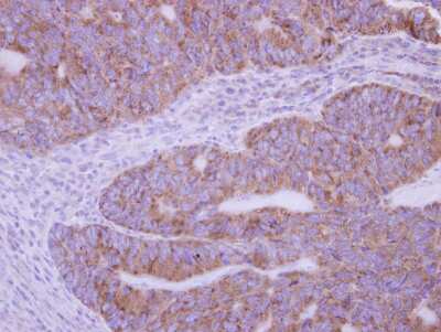 Immunohistochemistry-Paraffin: Phospholipase A2 XII Antibody [NBP2-19808]