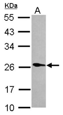 Western Blot: Phospholipase A2 XII Antibody [NBP2-19808]
