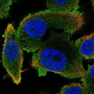 Immunocytochemistry/ Immunofluorescence: Phospholipase C beta 2 Antibody [NBP2-58951]