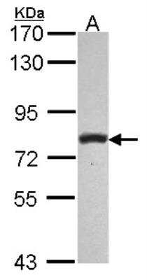 Western Blot: Phospholipase C delta 1 Antibody [NBP2-19810]