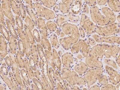 Immunohistochemistry-Paraffin: Phospholipase C like 1 Antibody [NBP3-06275]