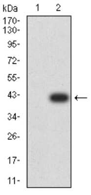 Western Blot: Phospholipase D2 Antibody (7E4D9)BSA Free [NBP2-61784]