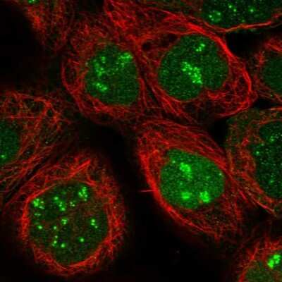Immunocytochemistry/ Immunofluorescence: Phosphopantothenate-cysteine ligase Antibody [NBP1-87398]