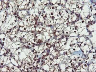 Immunohistochemistry: Phosphoribosyl Pyrophosphate Amidotransferase Antibody (OTI1B11) [NBP2-45379]