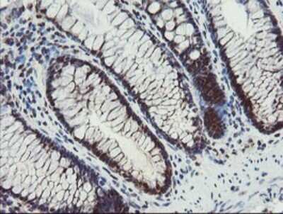 Immunohistochemistry: Phosphoribosyl Pyrophosphate Amidotransferase Antibody (OTI1B11) [NBP2-45379]