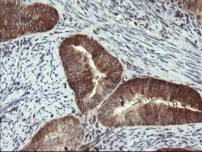 Immunohistochemistry: Phosphoribosyl Pyrophosphate Amidotransferase Antibody (OTI1B11) [NBP2-45379]